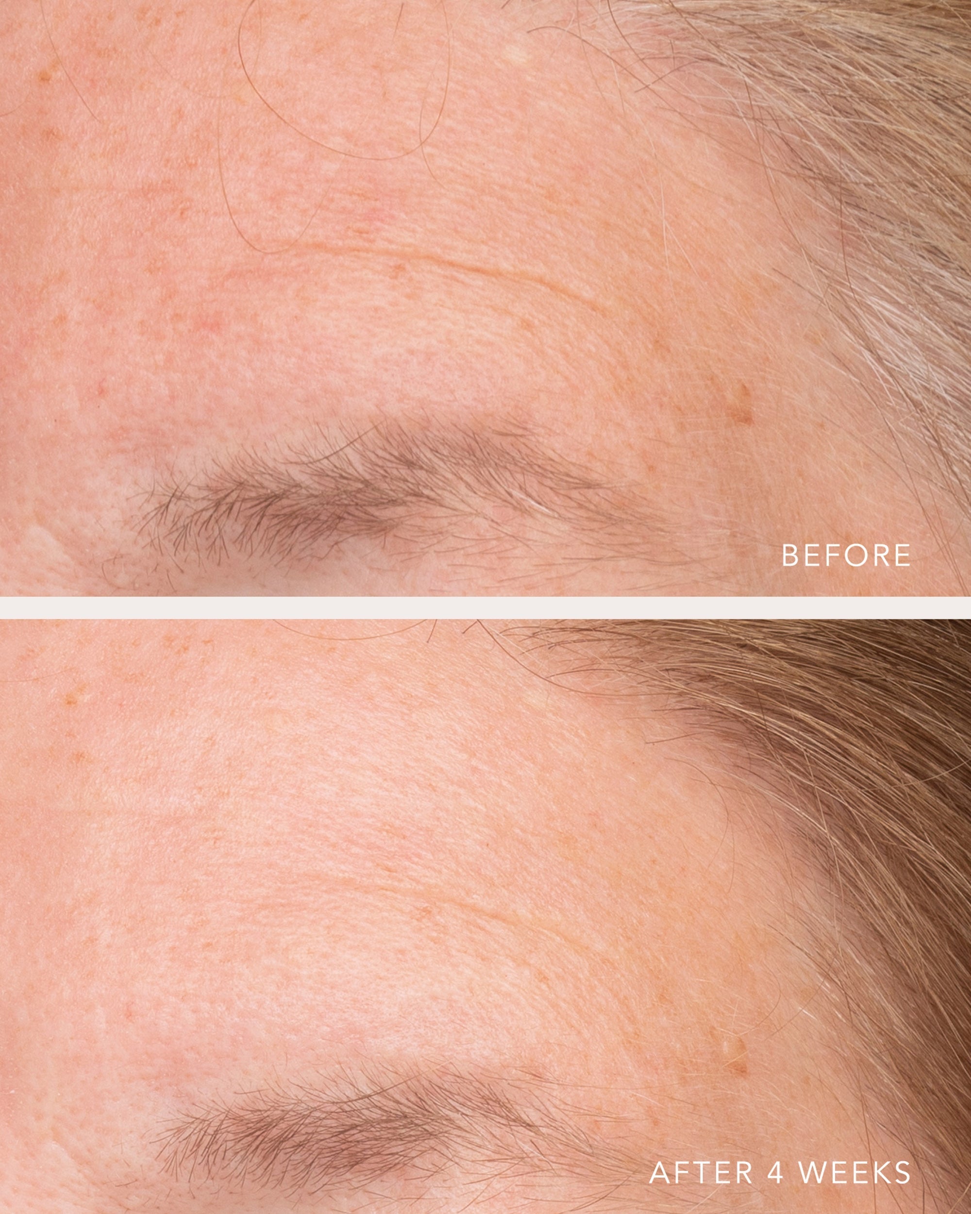 Ultra Hydrating Serum with Hyaluronic Complex-7