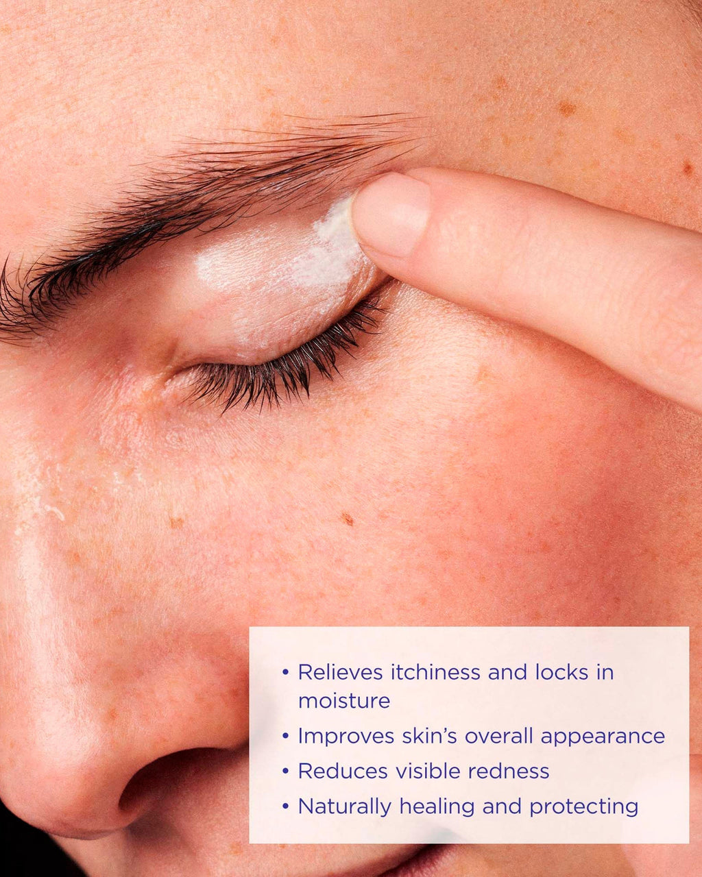 Healing Eczema Balm 50g